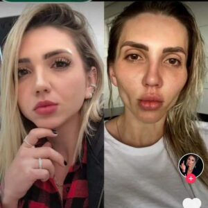 Essa Influencer se arrepende de ter feito bichectomia: ‘Flacidez gigantesca’